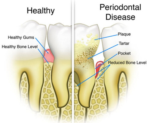 dental problems and treatment dental services markham